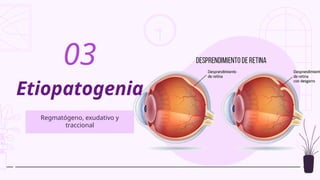 Etiopatogenia
Regmatógeno, exudativo y
traccional
03
 