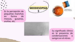 Es la percepción de
pequeñas manchas
en forma de
moscas, gusanos,
arañas, etc.
MIODESOPSIA
S
Su significado clínico
es la presencia de
condensaciones o
sangre en el vítreo.
 