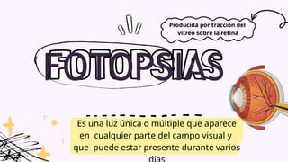 FOTOPSIAS
Es una luz única o múltiple que aparece
en cualquier parte del campo visual y
que puede estar presente durante varios
Producida por tracción del
vítreo sobre la retina
 