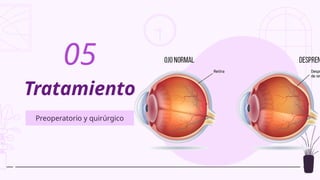 Tratamiento
Preoperatorio y quirúrgico
05
 