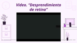 Video. “Desprendimiento
de retina”
 