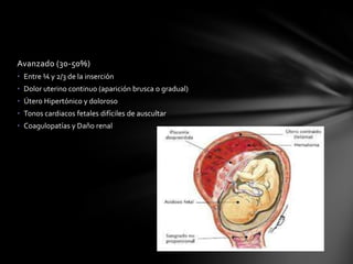 Avanzado (30-50%)
• Entre ¼ y 2/3 de la inserción
• Dolor uterino continuo (aparición brusca o gradual)
• Útero Hipertónico y doloroso
• Tonos cardiacos fetales difíciles de auscultar
• Coagulopatías y Daño renal
 
