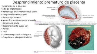 Desprendimiento prematuro de placenta
• Separación de la placenta
• Sitio de implantación
Hemorragia entre membranas y utero
• Luego cuello uterino y sale
• Hemorragia extrena
Menor frecuencia se queda atrapada
• Hemorragia oculta
• Desprendimiento puede ser:
• Parcial
• Total
• La hemorragia oculta Peligrosa
• Coagulapatia y Diagnostico lento
 