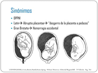 Sinónimos
   DPPNI
   Latín Abruptio placentae “desgarro de la placenta a pedazos”
   Gran Bretaña Hemorragia accide...