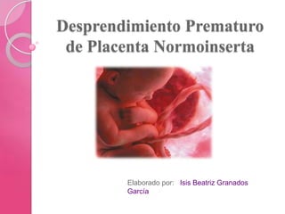 Desprendimiento Prematuro
de Placenta Normoinserta
Elaborado por: Isis Beatriz Granados
García
 