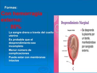 Formas:
Con hemorragía
externa:
- 80%
- La sangre drena a través del cuello
uterino
- Es probable que el
desprendimiento sea
incompleto
- Menor número de
complicaciones
- Puede estar con membranas
intactas
 