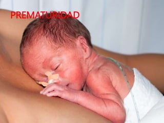 PREMATURIDAD
 