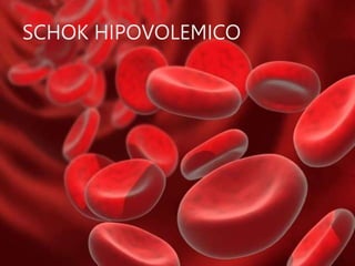 SCHOK HIPOVOLEMICO
 