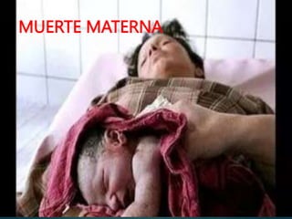 MUERTE MATERNA
 