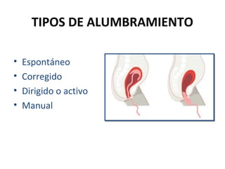 TIPOS DE ALUMBRAMIENTO
•
•
•
•

Espontáneo
Corregido
Dirigido o activo
Manual

 