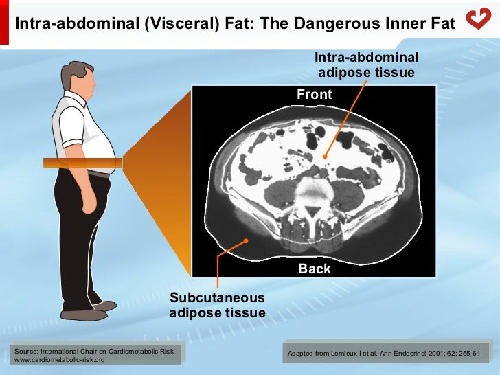 Abdominal obesity, intra-abdominal adiposity and related cardiometabo…