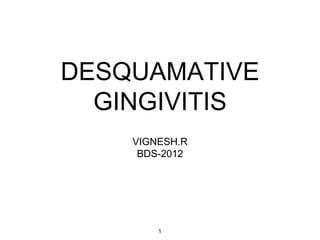 1
VIGNESH.R
BDS-2012
DESQUAMATIVE
GINGIVITIS
 