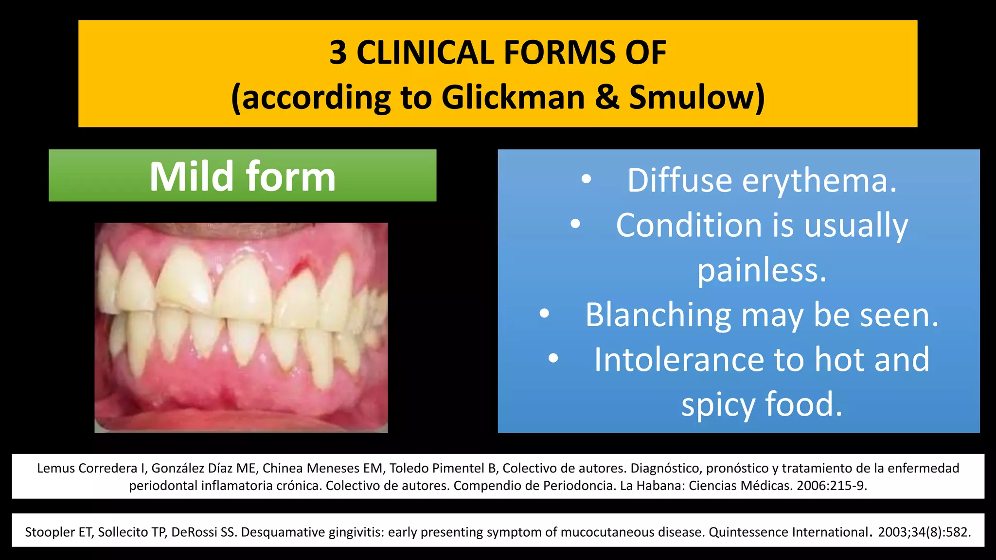 Desquamative gingivitis ppt | PPTX