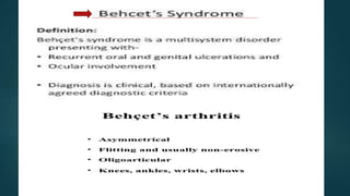 Behcet Disease:-
 