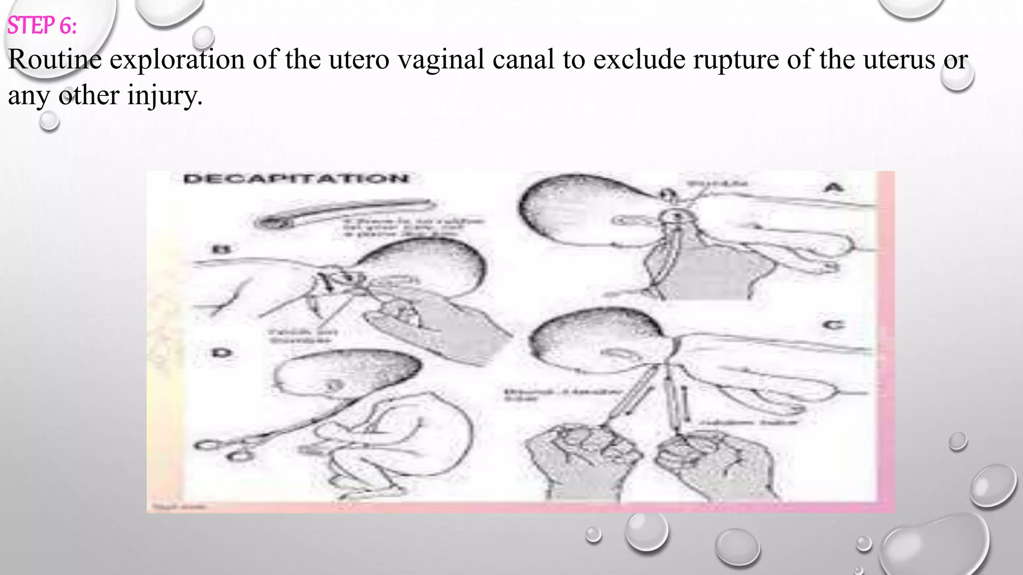 destructive operation (1).pptx