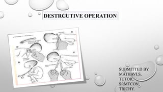 DESTRCUTIVE OPERATION
SUBMITTED BY
MATHAVI.S,
TUTOR,
SRMTCON,
TRICHY.
 