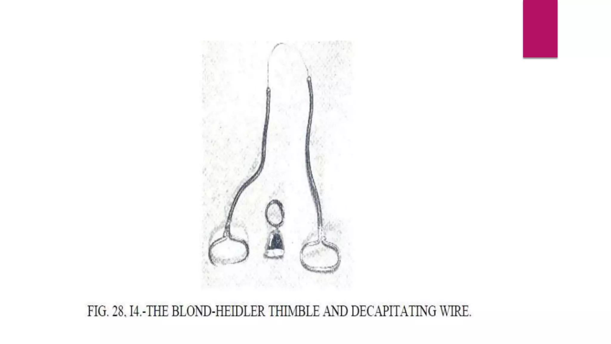 Destructive operations | PPTX