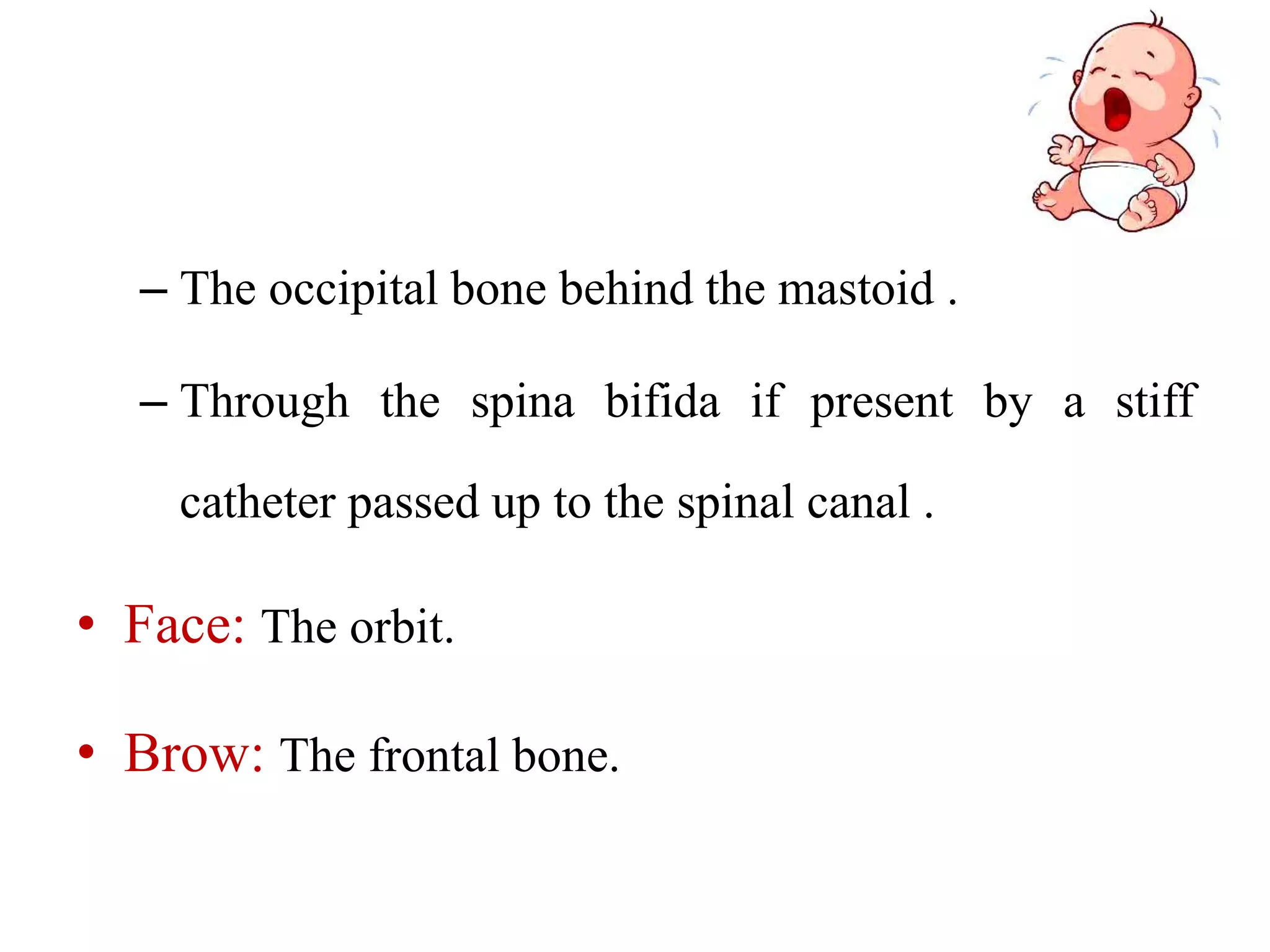 – The occipital bone behind the mastoid .
– Through the spina bifida if present by a stiff
catheter passed up to the spinal canal .
• Face: The orbit.
• Brow: The frontal bone.
 