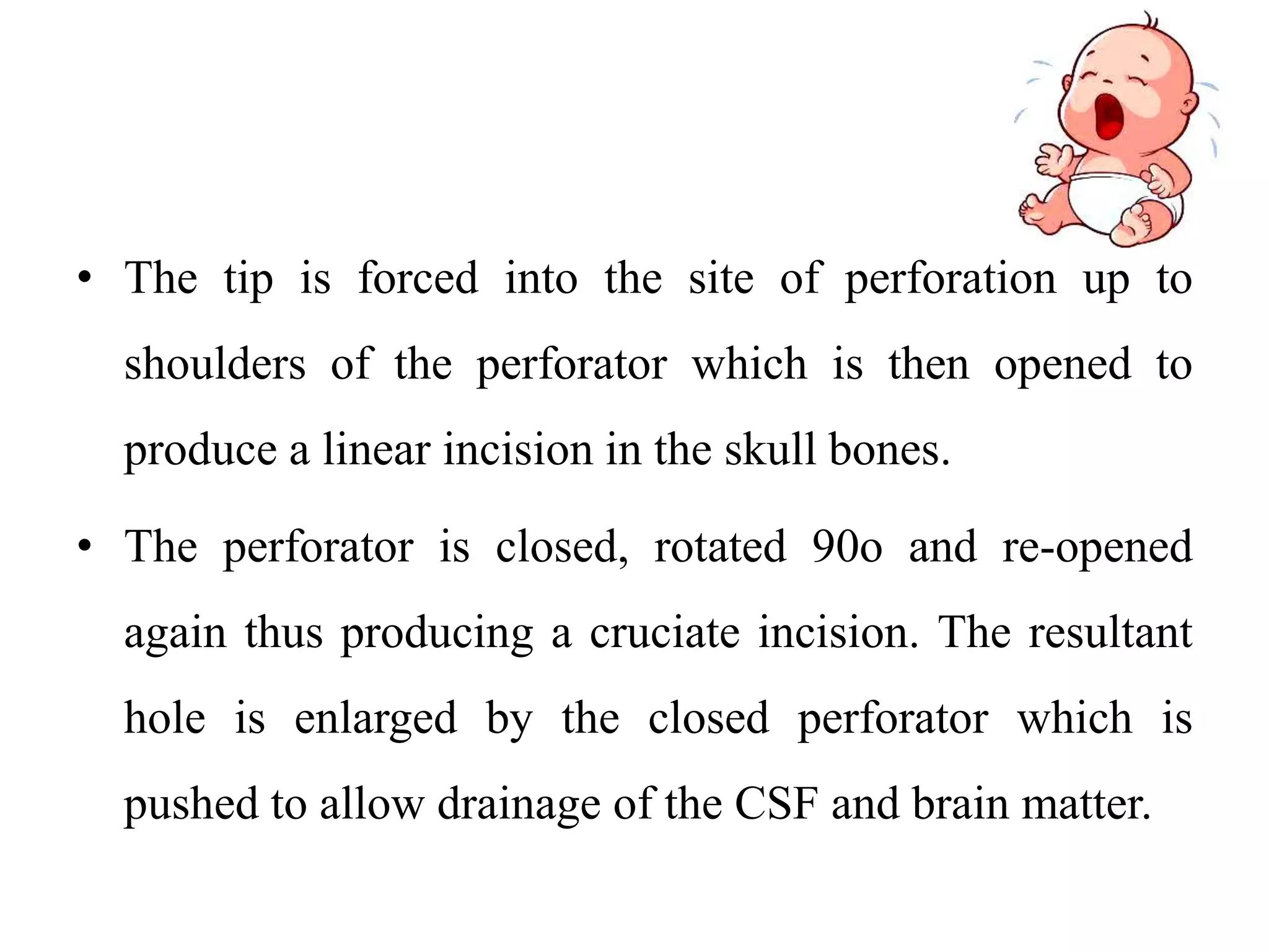 • The tip is forced into the site of perforation up to
shoulders of the perforator which is then opened to
produce a linear incision in the skull bones.
• The perforator is closed, rotated 90o and re-opened
again thus producing a cruciate incision. The resultant
hole is enlarged by the closed perforator which is
pushed to allow drainage of the CSF and brain matter.
 