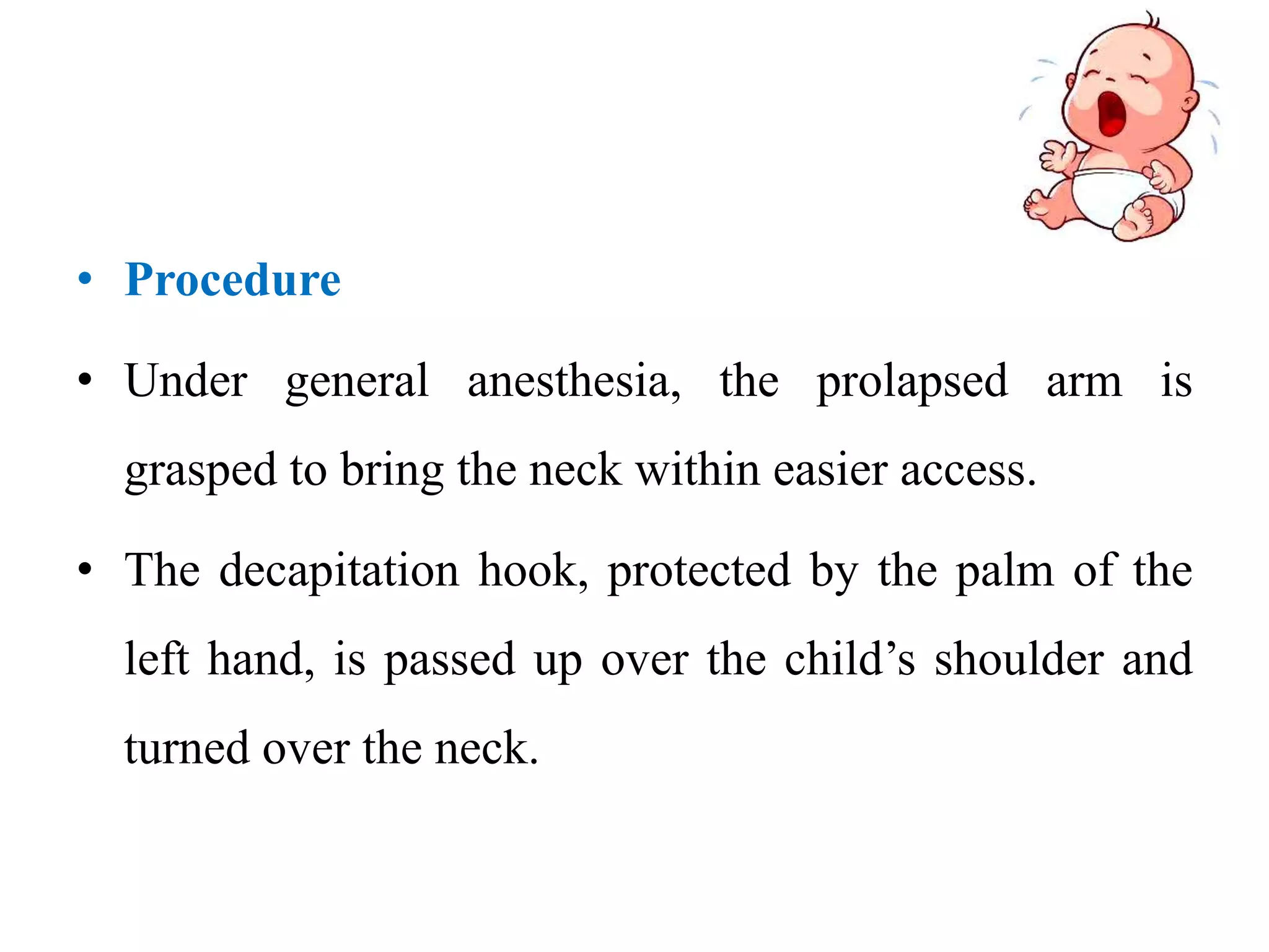 • Procedure
• Under general anesthesia, the prolapsed arm is
grasped to bring the neck within easier access.
• The decapitation hook, protected by the palm of the
left hand, is passed up over the child’s shoulder and
turned over the neck.
 