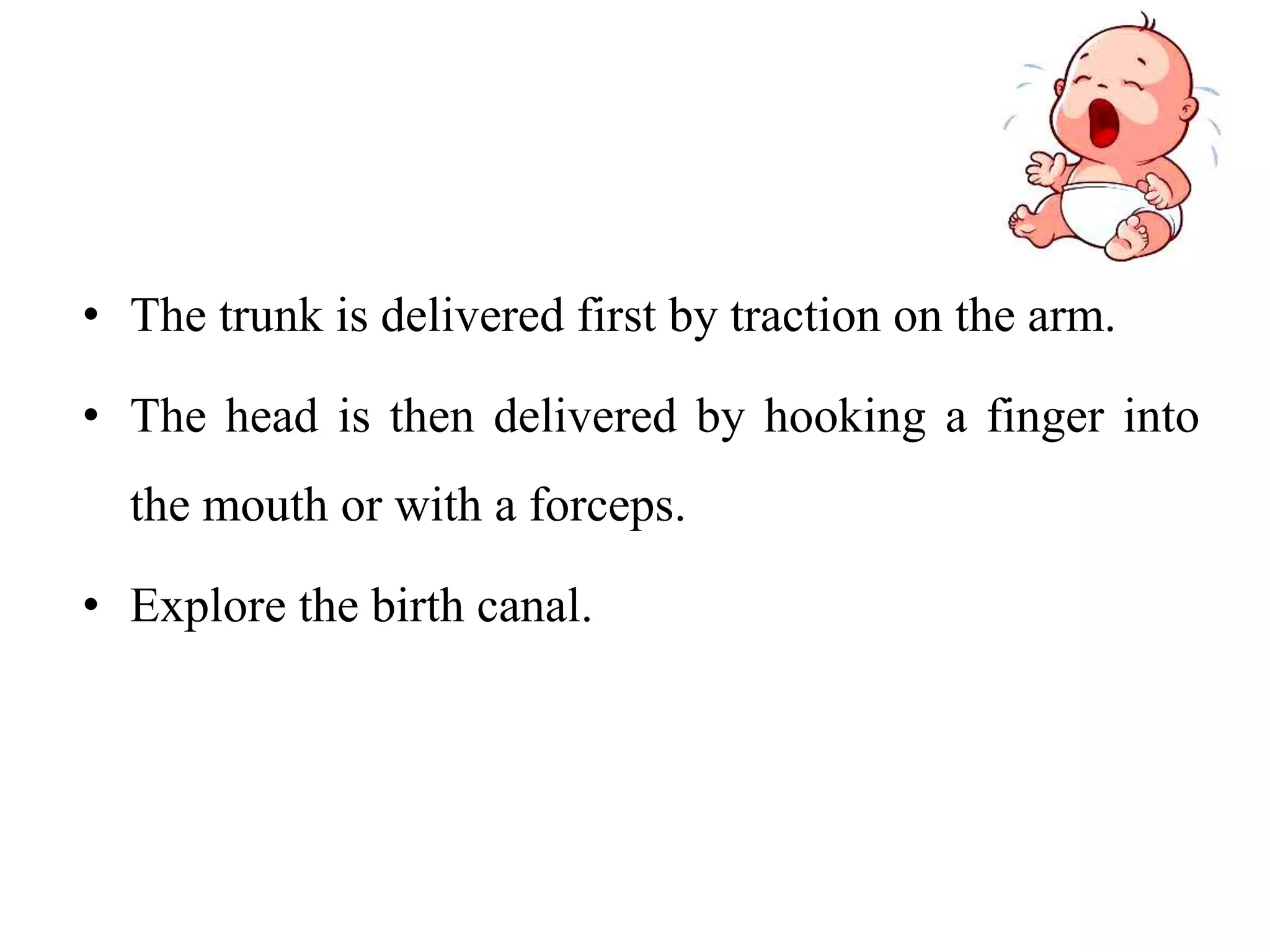 • The trunk is delivered first by traction on the arm.
• The head is then delivered by hooking a finger into
the mouth or with a forceps.
• Explore the birth canal.
 