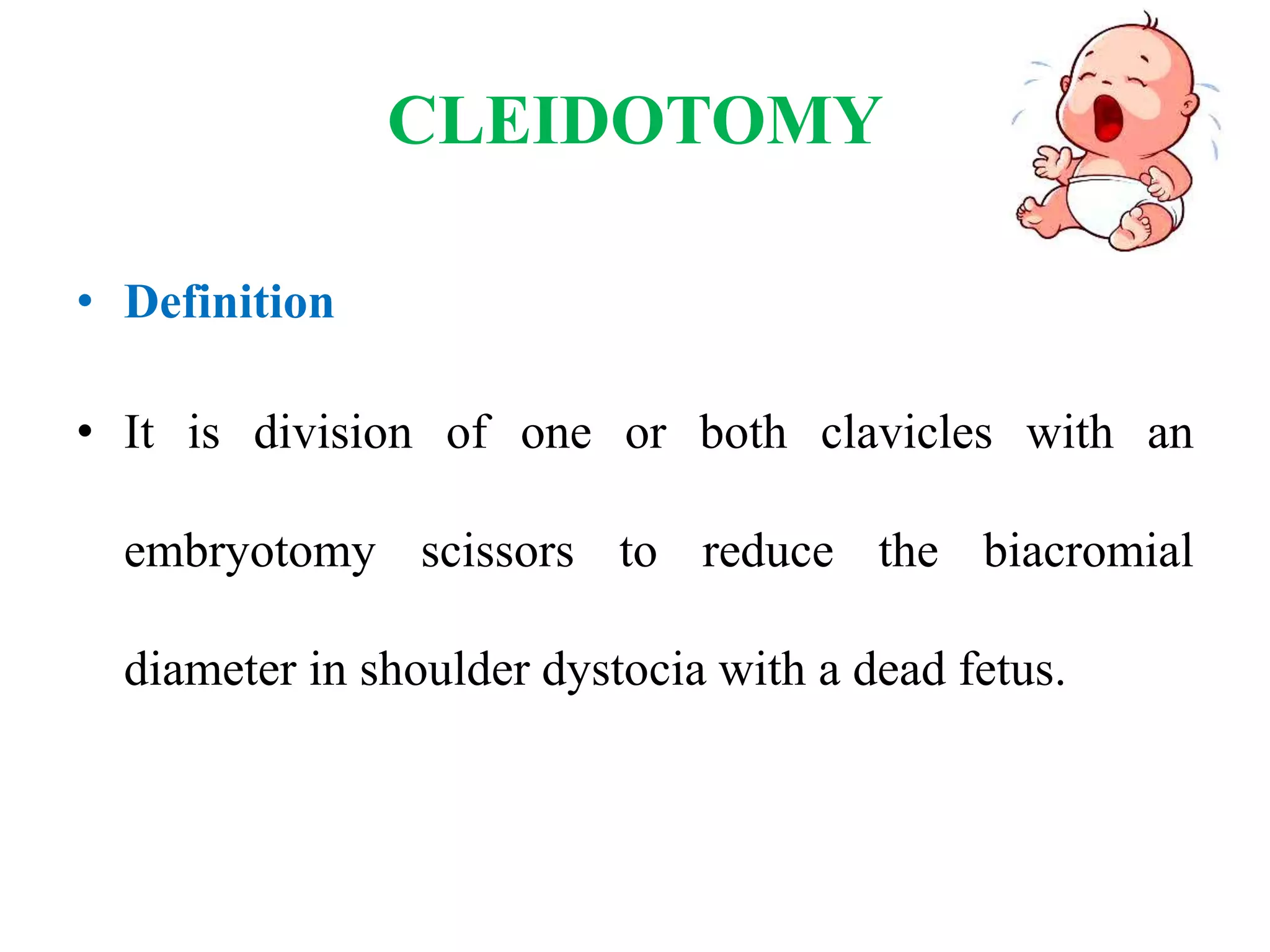 CLEIDOTOMY
• Definition
• It is division of one or both clavicles with an
embryotomy scissors to reduce the biacromial
diameter in shoulder dystocia with a dead fetus.
 