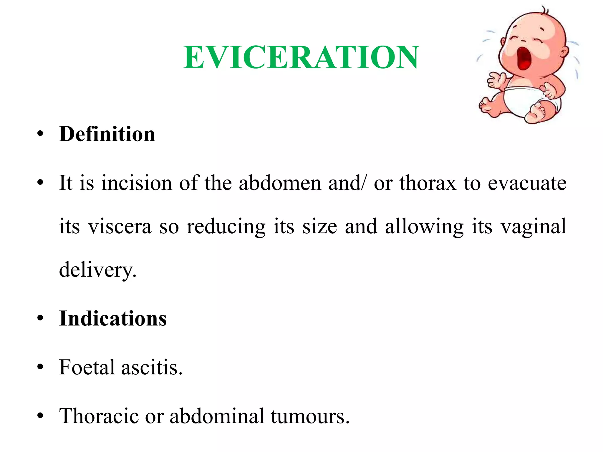 EVICERATION
• Definition
• It is incision of the abdomen and/ or thorax to evacuate
its viscera so reducing its size and allowing its vaginal
delivery.
• Indications
• Foetal ascitis.
• Thoracic or abdominal tumours.
 
