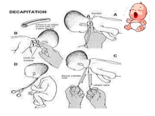 Dustructive Operations DESTRUCTIVE OPERATIONS 1.pptx