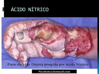 ÁCIDO NÍTRICO
 