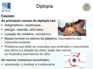 Causas:
As principais causas da diplopia são:
 Astigmatismo, ceratocone,
 pterígio, catarata, olho seco;
 Luxação do cristalino, estrabismo,
 Massa tumoral ou edema da pálpebra, traumatismo dos
músculos oculares;
 Problema que afeta os músculos que controlam o movimento
dos olhos e a direção do olhar, lesão dos nervos
ou músculos extrínsecos do olho;
Os nervos cranianos envolvidos:
 oculomotor, o troclear e o abducente
Diplopia
 