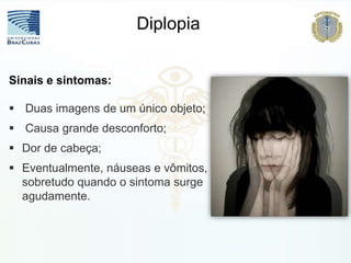 Diplopia
Sinais e sintomas:
 Duas imagens de um único objeto;
 Causa grande desconforto;
 Dor de cabeça;
 Eventualmente, náuseas e vômitos,
sobretudo quando o sintoma surge
agudamente.
 