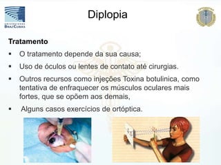 Diplopia
Tratamento
 O tratamento depende da sua causa;
 Uso de óculos ou lentes de contato até cirurgias.
 Outros recursos como injeções Toxina botulinica, como
tentativa de enfraquecer os músculos oculares mais
fortes, que se opõem aos demais,
 Alguns casos exercícios de ortóptica.
 