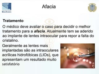 Afacia
O médico deve avaliar o caso para decidir o melhor
tratamento para a afacia. Atualmente tem se aderido
ao implante de lentes intraocular para repor a falta do
cristalino.
Tratamento
Geralmente as lentes mais
implantadas são as intraoculares
acrílicas hidrofóbicas (LIOs), que
apresentam um resultado muito
satisfatório
 