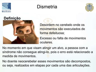 No momento em que visam atingir um alvo, a pessoa com a
síndrome não consegue atingi-lo, pois o erro está relacionado a
medida de movimentos.
No doente neocerebelar esses movimentos são decompostos,
ou seja, realizados em etapas por cada uma das articulações.
Definição
Desordem no cerebelo onde os
movimentos são executados de
forma defeituosa;
Excesso ou falta de movimentos
oculares.
Dismetria
 