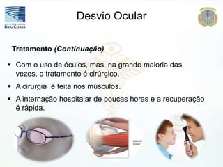 Desvio Ocular
 Com o uso de óculos, mas, na grande maioria das
vezes, o tratamento é cirúrgico.
 A cirurgia é feita nos músculos.
 A internação hospitalar de poucas horas e a recuperação
é rápida.
Tratamento (Continuação)
 