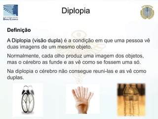 A Diplopia (visão dupla) é a condição em que uma pessoa vê
duas imagens de um mesmo objeto.
Normalmente, cada olho produz uma imagem dos objetos,
mas o cérebro as funde e as vê como se fossem uma só.
Na diplopia o cérebro não consegue reuni-las e as vê como
duplas.
Definição
Diplopia
 