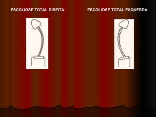 ESCOLIOSE TOTAL DIREITA ESCOLIOSE TOTAL ESQUERDA 