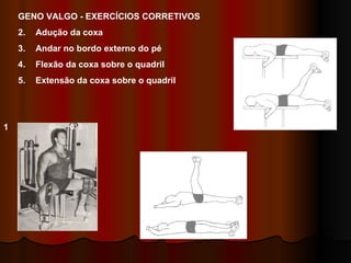 GENO VALGO - EXERCÍCIOS CORRETIVOS Adução da coxa Andar no bordo externo do pé Flexão da coxa sobre o quadril Extensão da coxa sobre o quadril 1 3 4 