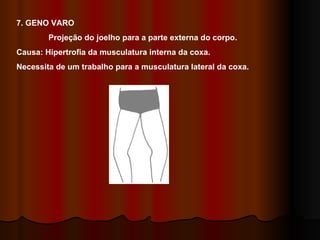 7. GENO VARO  Projeção do joelho para a parte externa do corpo. Causa: Hipertrofia da musculatura interna da coxa.  Necessita de um trabalho para a musculatura lateral da coxa. 