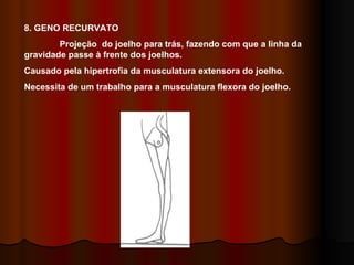8. GENO RECURVATO Projeção  do joelho para trás, fazendo com que a linha da gravidade passe à frente dos joelhos. Causado pela hipertrofia da musculatura extensora do joelho. Necessita de um trabalho para a musculatura flexora do joelho. 