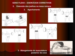 GENO FLEXO – EXERCÍCIOS CORRETIVOS Extensão dos joelhos na mesa romana Agachamento 3.  Alongamento da musculatura posterior da coxa 