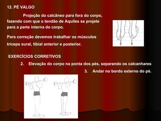 12. PÉ VALGO Projeção do calcâneo para fora do corpo, fazendo com que o tendão de Aquiles se projete para a parte interna do corpo. Para correção devemos trabalhar os músculos tríceps sural, tibial anterior e posterior. EXERCÍCIOS CORRETIVOS Elevação do corpo na ponta dos pés, separando os calcanhares Andar no bordo externo do pé. 