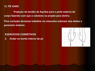 13. PÉ VARO Projeção do tendão de Aquiles para a parte externa do corpo fazendo com que o calcâneo se projete para dentro. Para correção devemos trabalhar os músculos extensor dos dedos e peroneiro anterior. EXERCÍCIOS CORRETIVOS Andar no bordo interno do pé 