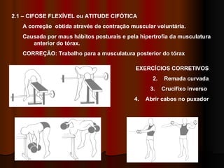 2.1 – CIFOSE FLEXÍVEL ou ATITUDE CIFÓTICA  A correção  obtida através de contração muscular voluntária.  Causada por maus hábitos posturais e pela hipertrofia da musculatura anterior do tórax. CORREÇÃO: Trabalho para a musculatura posterior do tórax EXERCÍCIOS CORRETIVOS Remada curvada Crucifixo inverso  Abrir cabos no puxador 1 2 3 