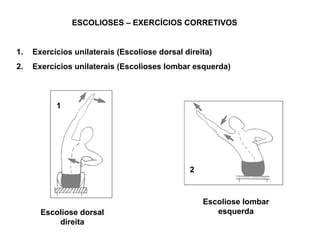 ESCOLIOSES – EXERCÍCIOS CORRETIVOS


1.   Exercícios unilaterais (Escoliose dorsal direita)
2.   Exercícios unilaterais (Escolioses lombar esquerda)



           1




                                               2



                                                   Escoliose lombar
       Escoliose dorsal                               esquerda
           direita
 