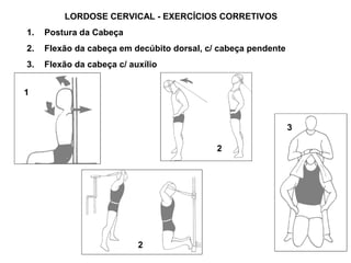 LORDOSE CERVICAL - EXERCÍCIOS CORRETIVOS
1.   Postura da Cabeça
2.   Flexão da cabeça em decúbito dorsal, c/ cabeça pendente
3.   Flexão da cabeça c/ auxílio


1



                                                               3

                                            2




                           2
 