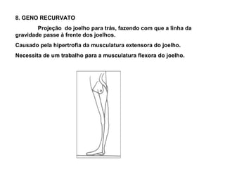 8. GENO RECURVATO
        Projeção do joelho para trás, fazendo com que a linha da
gravidade passe à frente dos joelhos.
Causado pela hipertrofia da musculatura extensora do joelho.
Necessita de um trabalho para a musculatura flexora do joelho.
 