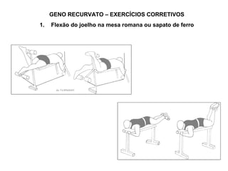 GENO RECURVATO – EXERCÍCIOS CORRETIVOS
1.   Flexão do joelho na mesa romana ou sapato de ferro
 