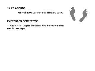 14. PÉ ABDUTO
        Pés voltados para fora da linha do corpo.


EXERCÍCIOS CORRETIVOS
1. Andar com os pés voltados para dentro da linha
média do corpo
 