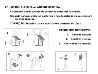 2.1 – CIFOSE FLEXÍVEL ou ATITUDE CIFÓTICA
         A correção obtida através de contração muscular voluntária.
         Causada por maus hábitos posturais e pela hipertrofia da musculatura
            anterior do tórax.
         CORREÇÃO: Trabalho para a musculatura posterior do tórax

                                                    EXERCÍCIOS CORRETIVOS
 1                                                         1.   Remada curvada
                                                          2.    Crucifixo inverso
                                                    3.   Abrir cabos no puxador



     2




                                                3
 